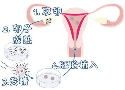 关于私人高龄代怀助孕服务哪家好